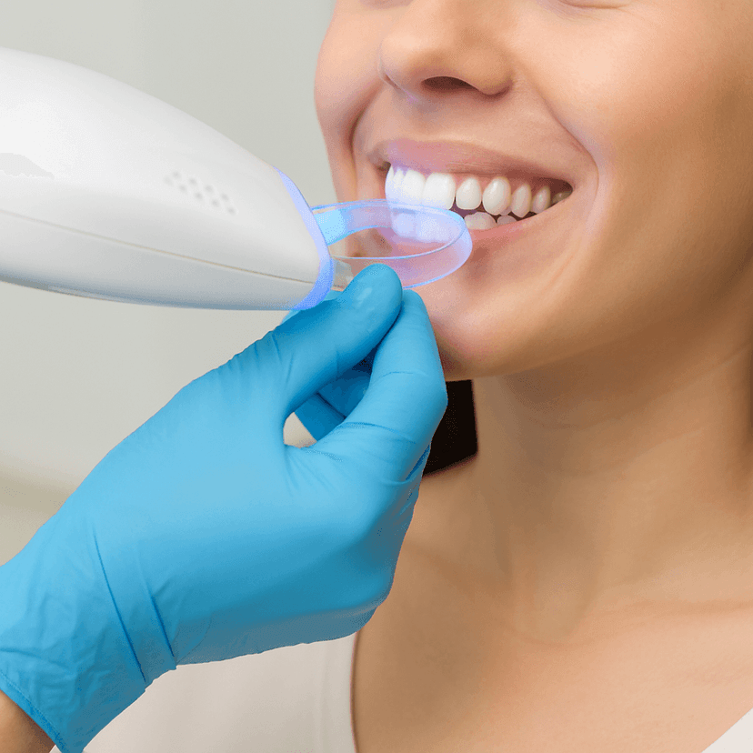Teeth Whitening